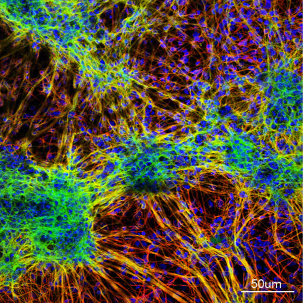 Immunostaining for Tau, green